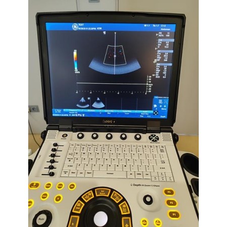 GE Logiq e R8 Ultraschallgerät