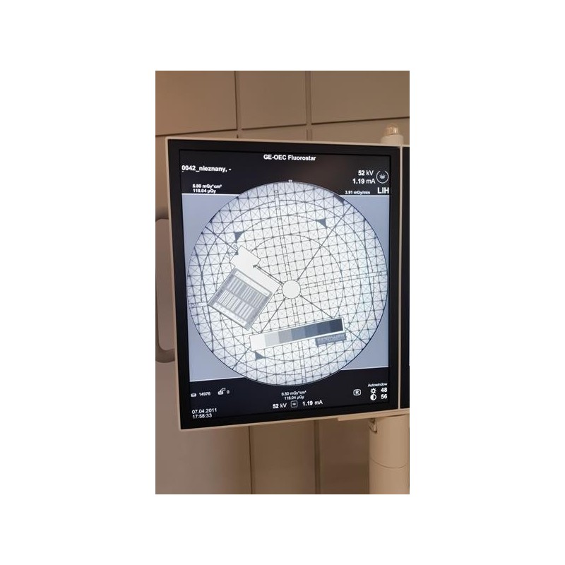 GE OEC 7900 Fluorostar Compact C-Arm X-Ray Unit