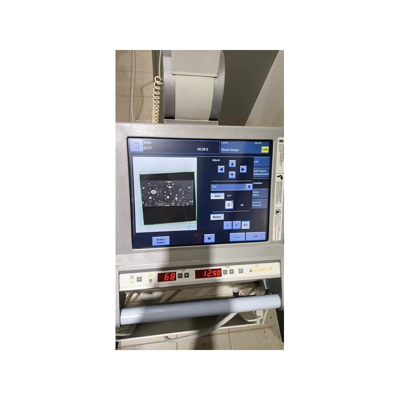 Mobilny aparat RTG Siemens Mobilett Digital
